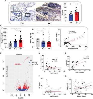 HAPLN1 Affects Cell Viability and Promotes the Pro-Inflammatory Phenotype of Fibroblast-Like Synoviocytes